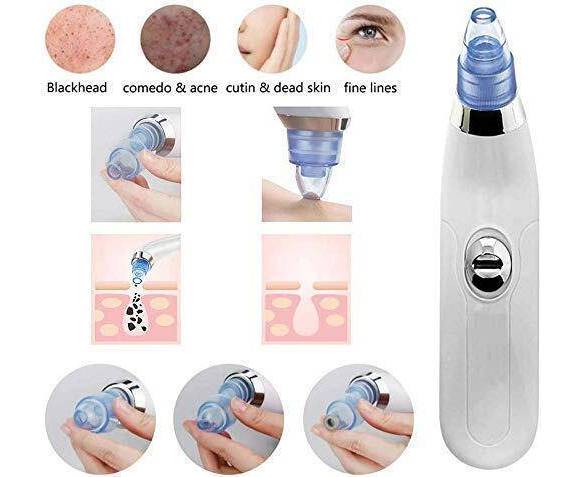 Premium Blackhead Removal Machine-derma Suction 4 In 1 (Cell Operated)