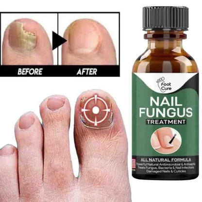 Fast Nail Fungal Treatments Nail Repair Essences Serum