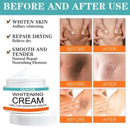 Pack Of 2 | Sensitive Area Whitening Cream